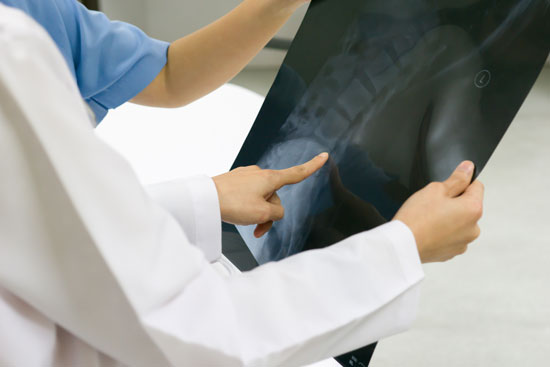 Los Angeles spinal cord injury lawyer is ready to assist this patient whose spinal x-ray is being viewed by a doctor